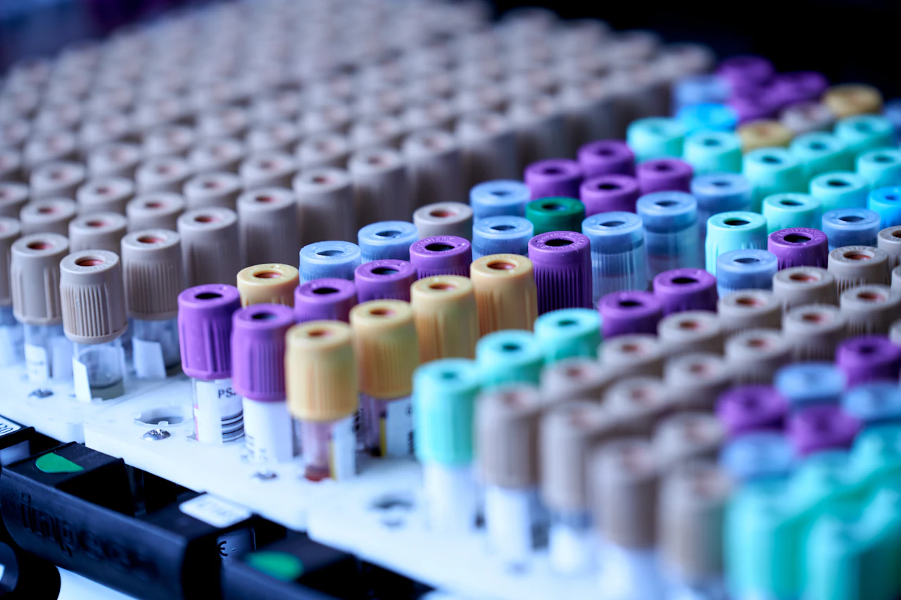 Rows of blood sample tubes with coloured caps in a laboratory rack